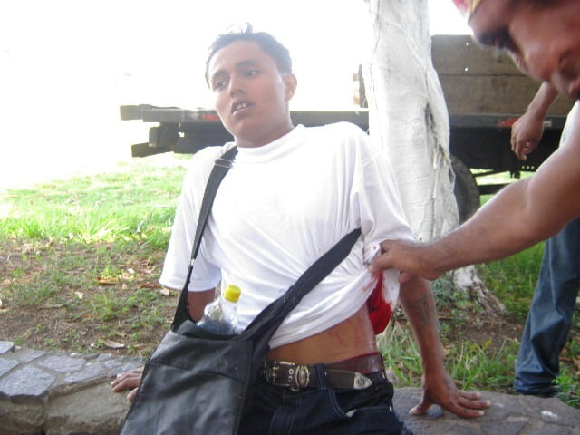 Juan Francisco Mendieta Davila, herido por su amigo de tragos